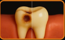 الحشوات التجميلية